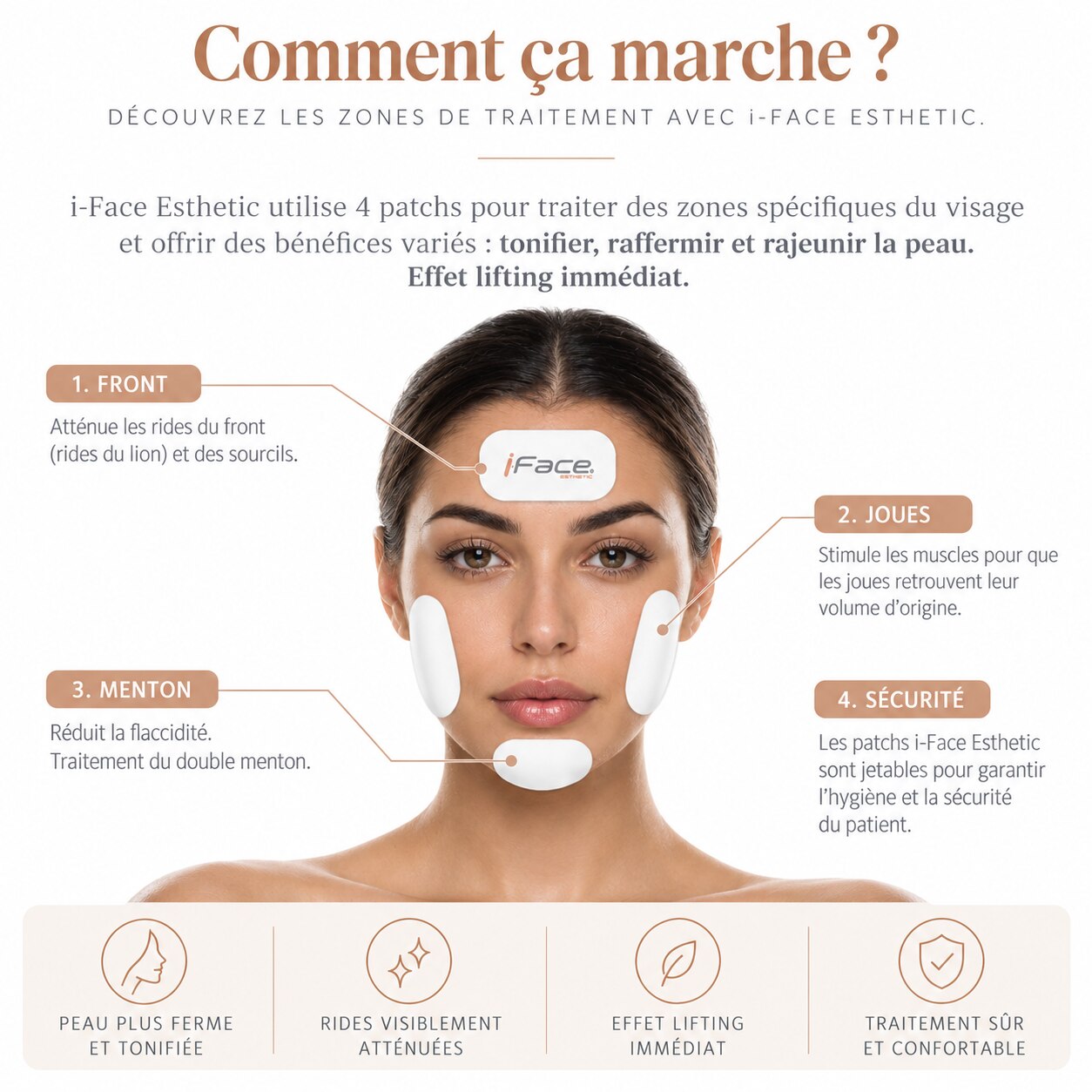 T-Model — schéma des zones de traitement par électrostimulation faciale